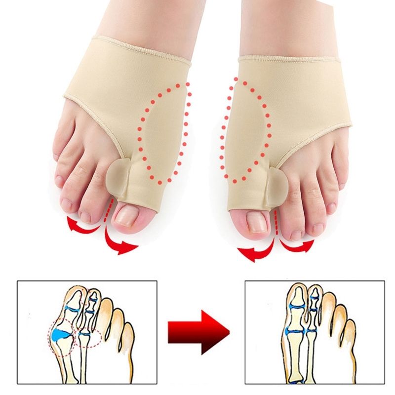 Correcteur hallux valgus orteils