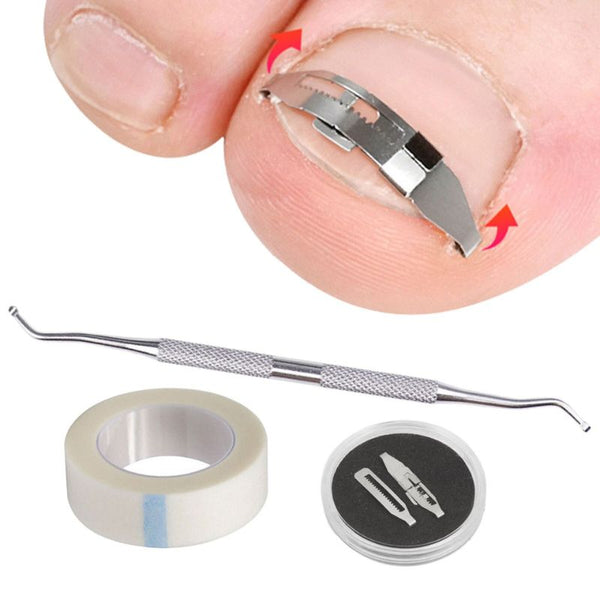 Correcteur ongle incarné