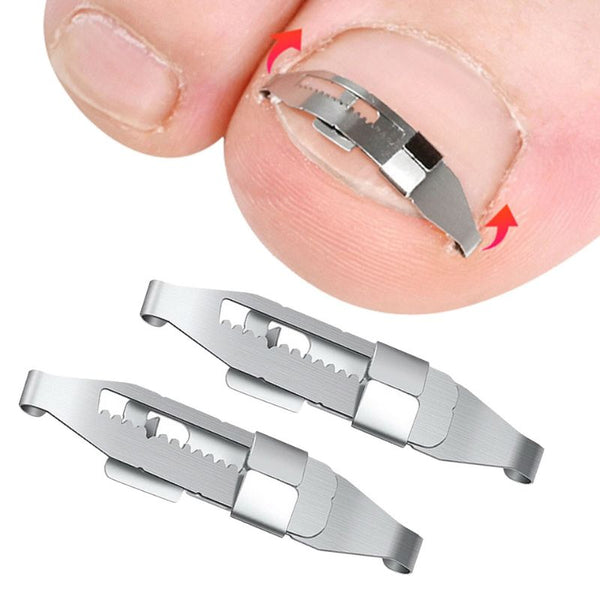 Correcteur ongle incarné