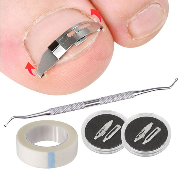 Correcteur ongle incarné