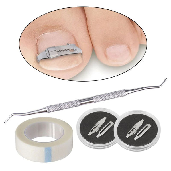 Correcteur ongle incarné